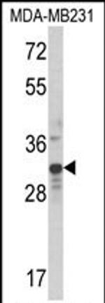 MLX Antibody in Western Blot (WB)