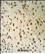 TARSL2 Antibody in Immunohistochemistry (IHC)