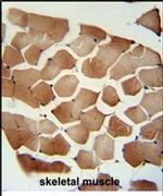 Folliculin Antibody in Immunohistochemistry (IHC)