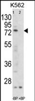 Folliculin Antibody in Western Blot (WB)