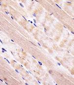 RAB7A Polyclonal Antibody
