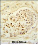 Cbl-b Antibody in Immunohistochemistry (IHC)
