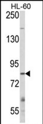 Cbl-b Antibody in Western Blot (WB)