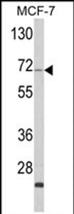 ZYG11A Antibody in Western Blot (WB)