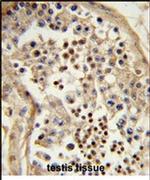 TBATA Antibody in Immunohistochemistry (IHC)