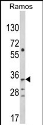 TBATA Antibody in Western Blot (WB)
