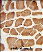 PECI Antibody in Immunohistochemistry (IHC)