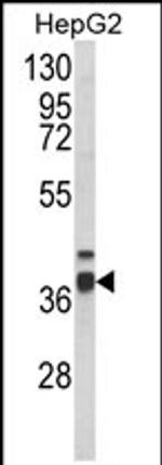 PECI Antibody in Western Blot (WB)