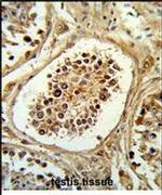 PHD1 Antibody in Immunohistochemistry (IHC)