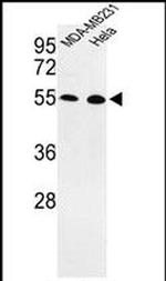PHD1 Antibody in Western Blot (WB)
