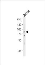 HSPA6 Antibody in Western Blot (WB)
