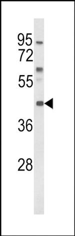 MC3R Antibody in Western Blot (WB)