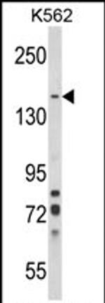 SorCS1 Antibody in Western Blot (WB)