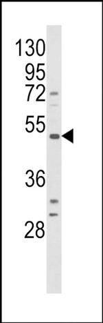 B1 Bradykinin Receptor Antibody in Western Blot (WB)