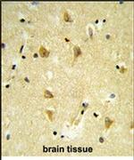 MPV17 Antibody in Immunohistochemistry (IHC)