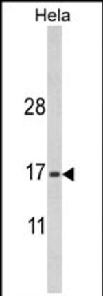 MPV17 Antibody in Western Blot (WB)