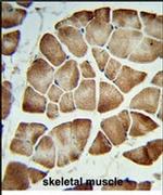 COQ3 Antibody in Immunohistochemistry (IHC)