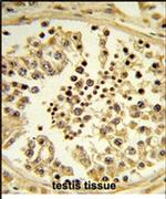 Importin 11 Antibody in Immunohistochemistry (IHC)