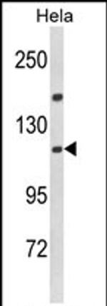 Importin 11 Antibody in Western Blot (WB)