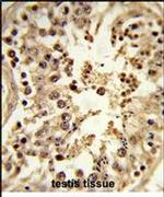 Cdc42EP3 Antibody in Immunohistochemistry (IHC)