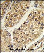 CSGALNACT2 Antibody in Immunohistochemistry (IHC)