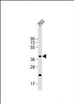 CSGALNACT2 Antibody in Western Blot (WB)