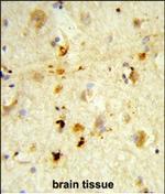 ITGBL1 Polyclonal Antibody