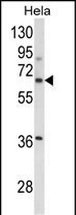 ITGBL1 Antibody in Western Blot (WB)