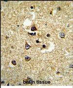 CYP7B1 Antibody in Immunohistochemistry (IHC)