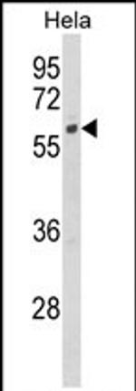 CYP7B1 Antibody in Western Blot (WB)