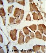 TAZ Polyclonal Antibody