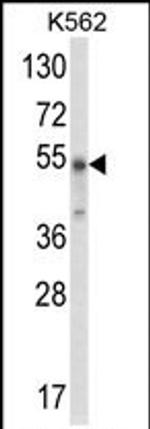 WDSUB1 Antibody in Western Blot (WB)