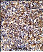 COTL1 Antibody in Immunohistochemistry (IHC)