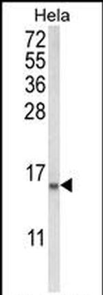 COTL1 Antibody in Western Blot (WB)