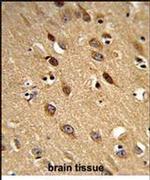 PISD Antibody in Immunohistochemistry (IHC)