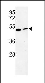 PISD Antibody in Western Blot (WB)