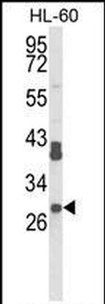 RPS8 Antibody in Western Blot (WB)
