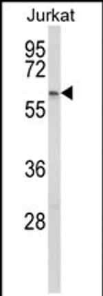 PCCB Antibody in Western Blot (WB)