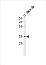 ATF7 Antibody in Western Blot (WB)