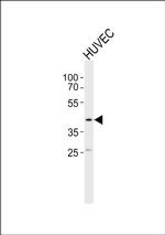LOX-1 Antibody in Western Blot (WB)