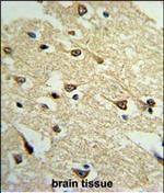 Adenylate Cyclase 8 Polyclonal Antibody