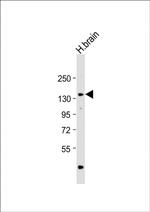 Adenylate Cyclase 8 Antibody in Western Blot (WB)