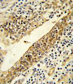 CYP51A1 Antibody in Immunohistochemistry (IHC)