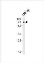 CYP51A1 Antibody in Western Blot (WB)