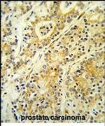 MGST2 Antibody in Immunohistochemistry (IHC)