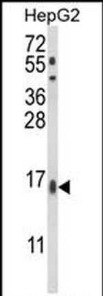 MGST2 Antibody in Western Blot (WB)