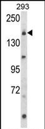 UNC13B Antibody in Western Blot (WB)