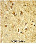 ADAMTS18 Antibody in Immunohistochemistry (IHC)