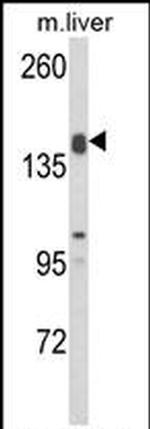 ADAMTS18 Antibody in Western Blot (WB)