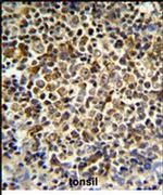 KIR2DL5B Antibody in Immunohistochemistry (IHC)